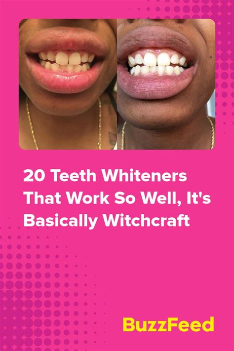 Witchcraft white teeth illuminating